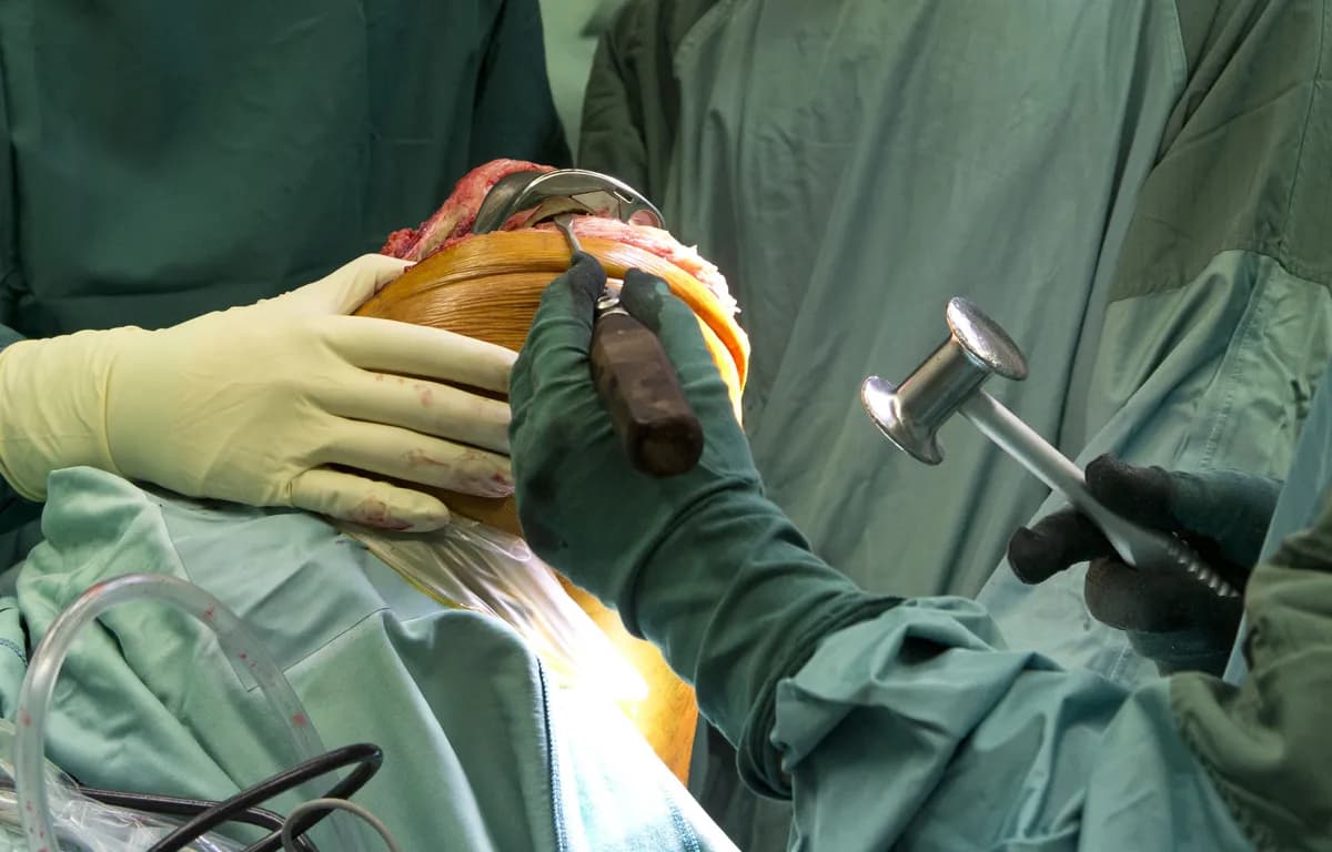 Bone density wait times cut from two years to four months