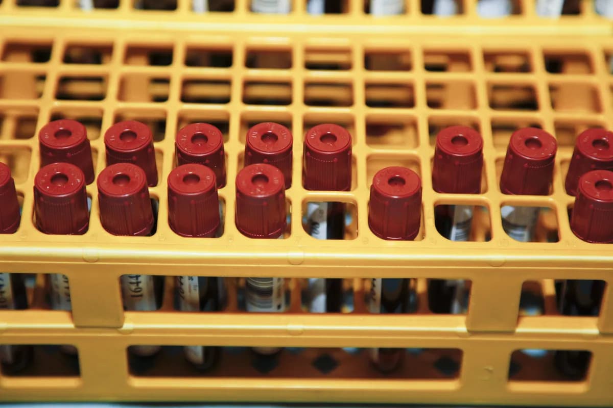 Östergötland står inför kritisk blodbrist inför påskhelgen