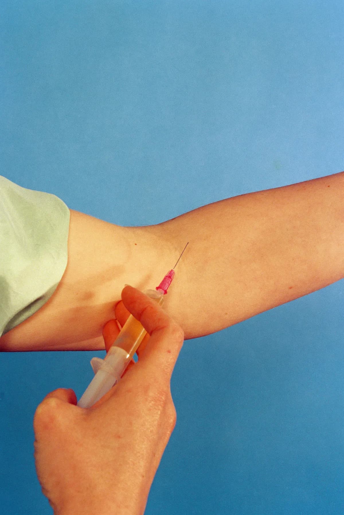 Fler unga kvinnor överväger Botox trots hälsorisker